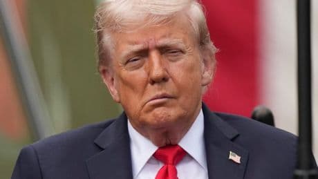 Donald Trump’s ‘droopy face’ sparks stroke fears – here’s what health experts think