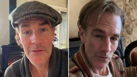 James Van Der Beek (Dawson's Creek) e il tumore al colon: «Pensavo fosse colpa del caffè e ho ignorato un sintomo chiave, non fate come me»