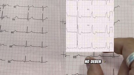 Aurelio Rojas, cardiólogo, explica cómo interpretar un electrocardiograma: “Entender tu electrocardiograma puede salvarte la vida”