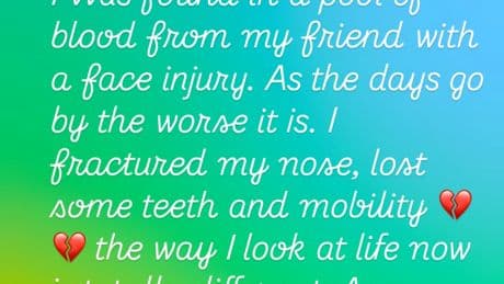 Tamar Braxton ‘almost died’ after waking up in pool of blood with fractured nose, missing teeth