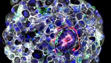 World’s ‘oldest baby’ born from embryo frozen in 1994
