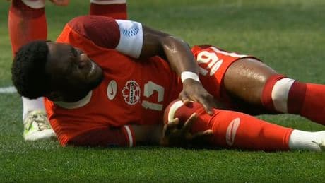 „Mein ganzes Bein war ...“ - Bayern-Star Davies verrät Details über Horror-Verletzung