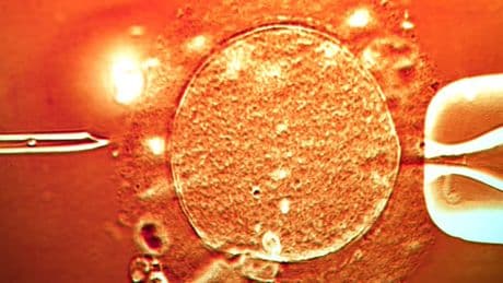 In Großbritannien werden Babys mit drei Eltern geboren
