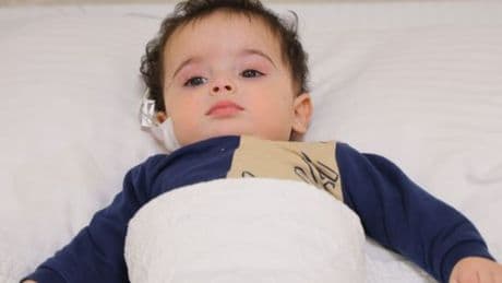 Boğazına havuç kaçan bebek, 10 dakikada hayata döndü!