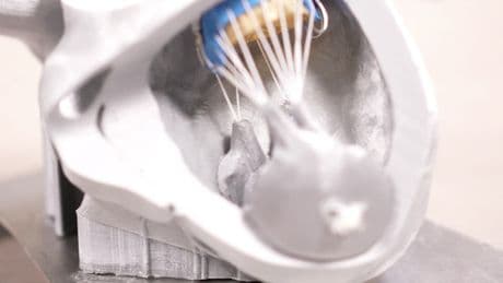 Fondazione ENEA Tech e Biomedical investe 4 milioni di euro in InnovHeart, PMI innovativa attiva nella sostituzione transcatetere della valvola mitrale
