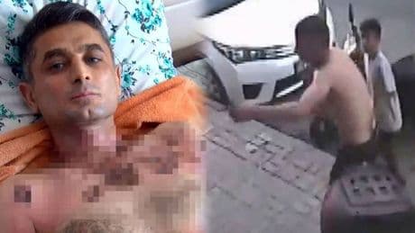 Gasbetti, yaktı, tehdit etti: Şüpheli hâlâ serbest! İşitme ve konuşma engelli adamın hayatını cehenneme çevirdiler
