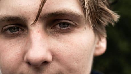 Drogenepidemie in den USA: "Ich habe die Zombie-Droge überlebt. Das können nicht viele sagen"