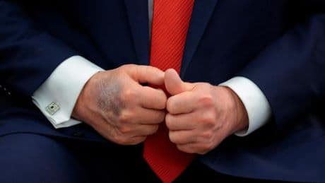 USA: Bluterguss sorgt für Spekulation über Gesundheit von Trump
