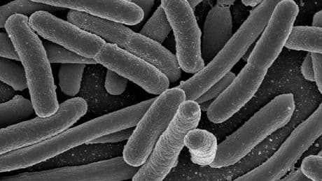 Florida reports 21 E. Coli cases linked to raw milk consumption