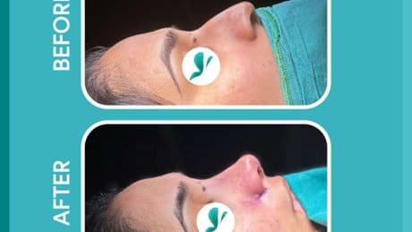 Trusted by Thousands: Luviacure’s Patient-Centered Approach Transforms Medical Tourism