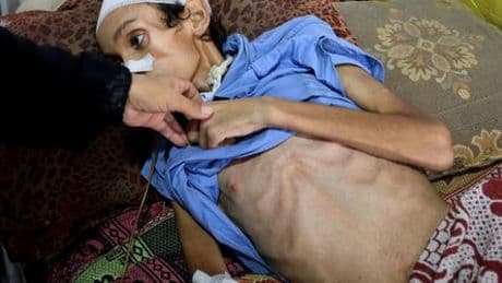 Gaza: Mehr als 111 Hilfsorganisationen warnen vor Massenhungersnot