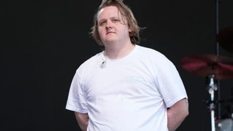 Lewis Capaldi Calls Out 'Not Fair' Double Standard For Women In Pop Music