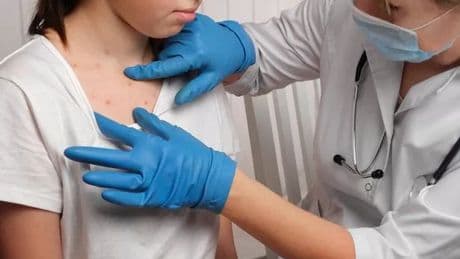 Urgent new alert as 'highly infectious' disease continues to spread in UK