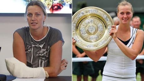 Former Wimbledon champion tells how terrifying knife attack left her battling anxiety, nightmares and flashbacks - after ordeal left her with irreversible damage