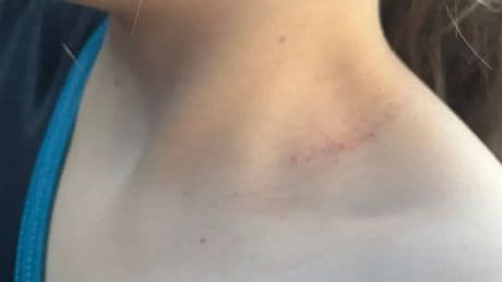 Scots mum fears as boy 'tries to strangle her daughter' at primary school