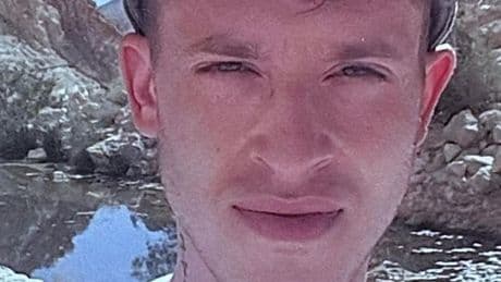 Edinburgh man's parasite terror after mites lay eggs under skin