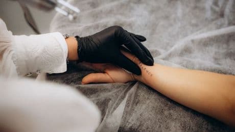 'I thought removing my tattoo would be easy – here’s the reality a year on'