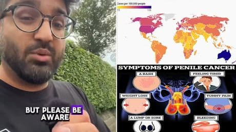 Men with THIS body feature are more likely to develop cancer, experts warn