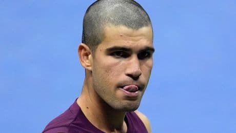Alcaraz sobre su corte de pelo: “Mi hermano se equivocó con la máquina... y la única manera de arreglarlo es raparlo”
