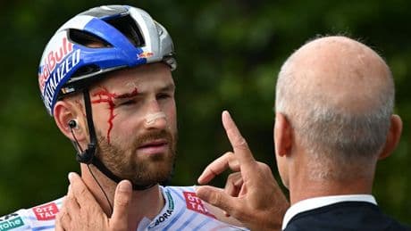 Stürze bei der Tour de France: Radfahrer benötigen bessere Schutzkleidung