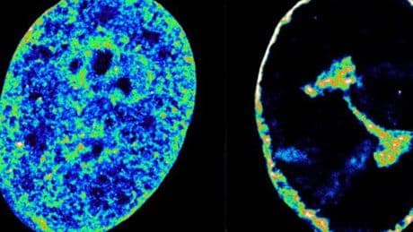 Cold sore virus takes over human DNA within just one hour, study finds