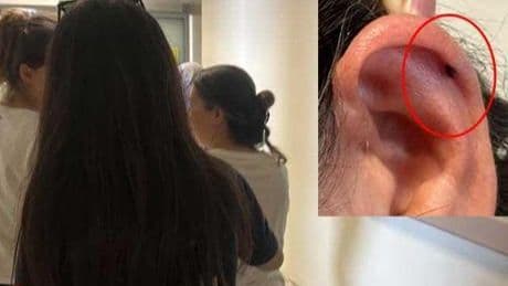 Kulağında fark etti, hemen hastaneye koştu