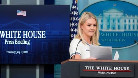 Trump is checked for swelling in legs and was diagnosed with a common condition in older adults