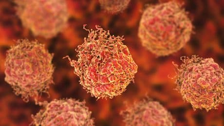 What Does a Gleason Score of 9 Mean? Understanding Biden’s Prostate Cancer Diagnosis