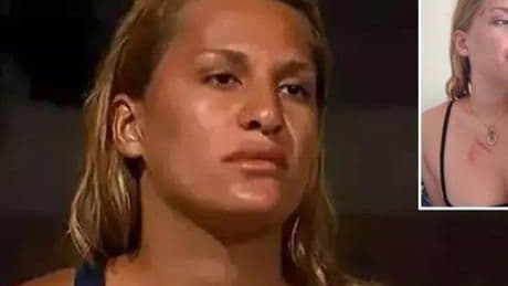 Survivor Almeda Baylan ölümden dönmüştü! Aracın geldiği hali paylaştı