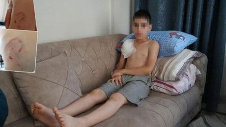 Samsun'da sahipli köpek dehşeti: Sol kolu felç kaldı, hayatı kabusa döndü
