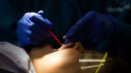 The FDA Might Ban Fluoride Supplements. Dentists Are Upset