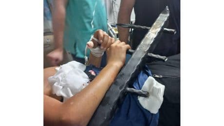 Ağaçtan demir çitinin üzerine düştü! 12 yaşındaki çocuğa İzmir İtfaiyesi’nden hayat kurtaran operasyon