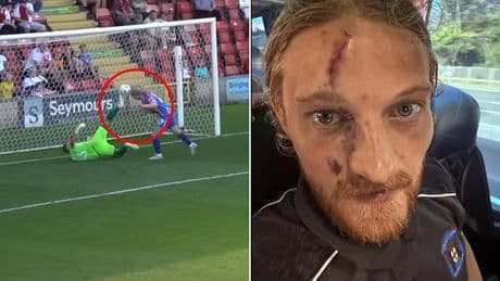 Footballer left with horror facial injury after being kicked in the HEAD by opponent during match