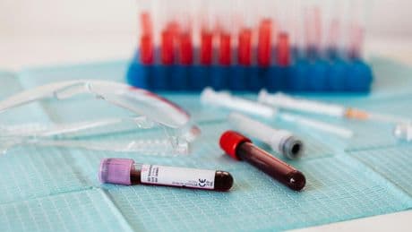 Encontrar tests rápidos y fiables para el Alzheimer es una misión clave para la ciencia. Y tenemos un nuevo candidato