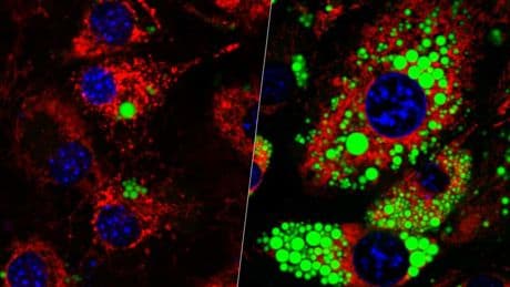 Perder peso sin perder músculo es el gran reto de fármacos como Ozempic. Una proteína guarda la clave para afrontarlo