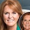 Sarah Ferguson's changing face: How the Duchess was a 'guinea pig' for new cosmetic treatments