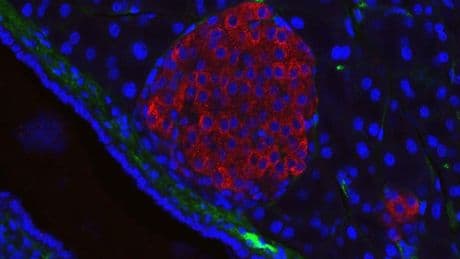 A New Chapter For Diabetes—and Regenerative Medicine