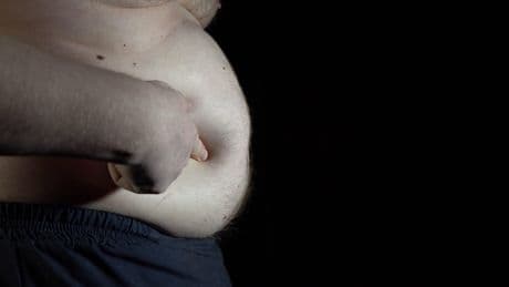 Il Regno Unito lascia senza cure gli obesi, ma paga cambio sesso e suicidio assistito
