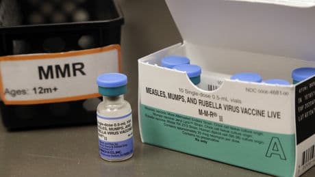 Toronto Public Health warns of possible measles exposure at major tourist attraction