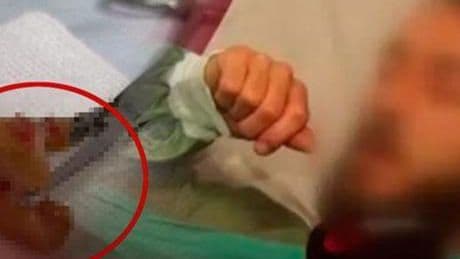 Uykuda diş kâbusu! Aynada fark etti, ciğerinden çıktı: 'Çok sık görmeye başladık'