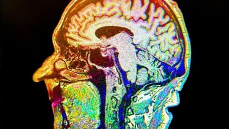 Steering clear of one beverage may slash Alzheimer's and dementia risk