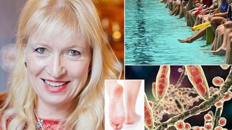 You should NEVER ignore crusty, white heels: GP warns this type of 'dry skin' on the feet is a sign of infection that could even be fatal