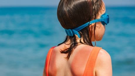 Heatstroke In Children And Babies: Key Symptoms To Watch For