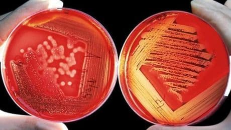 Un gen que convierte a las bacterias en superresistentes se propaga por todo el mundo: "Son casi incurables"