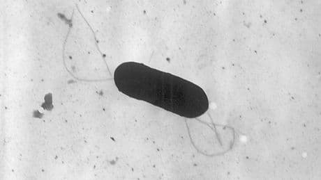 Listeria outbreak which hospitalized 10 people in the U.S. linked to prepared foods