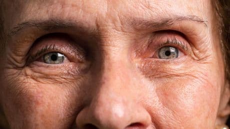 Demenz erkennen: Augen als Warnsignal beginnenden Gedächtnisverlusts