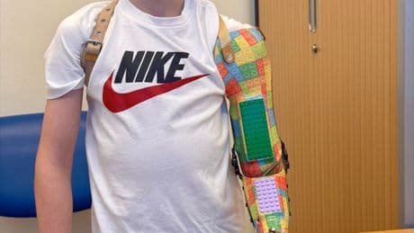 Brave lad, 8, who suffers with underdeveloped arm tries out new prosthetic arm made with Lego design & real blocks