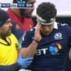 Commotions cérébrales dans le rugby : des figures de l'ovalie, dont Sébastien Chabal, tirent la sonnette d'alarme