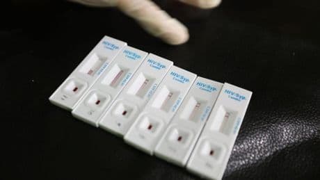 Cae un 60% el número de vascos que se hace un test rápido de VIH pese al aumento de los contagios