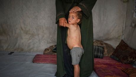 PHOTO GALLERY: Scenes from Gaza